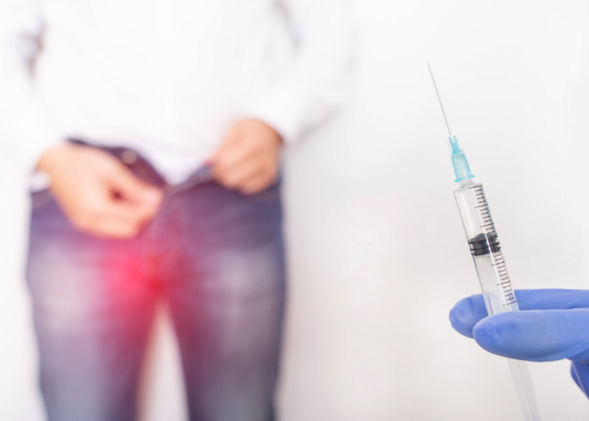 Varicocele Treatment